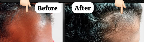 Hair Regrowth Serum