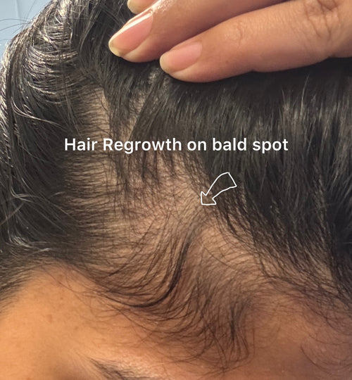 Hair Regrowth Serum